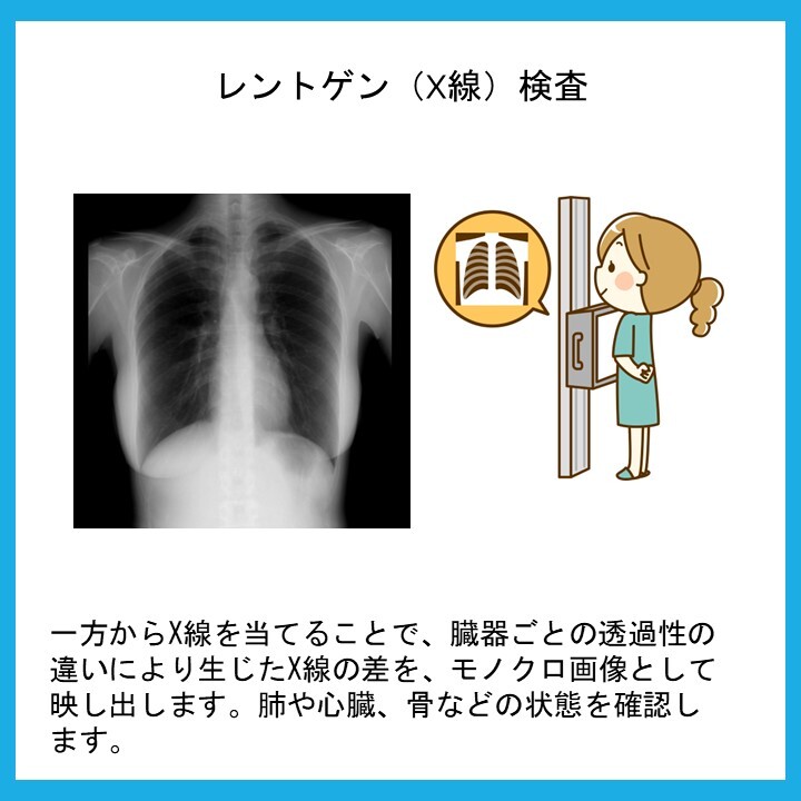 レントゲン（X線）検査