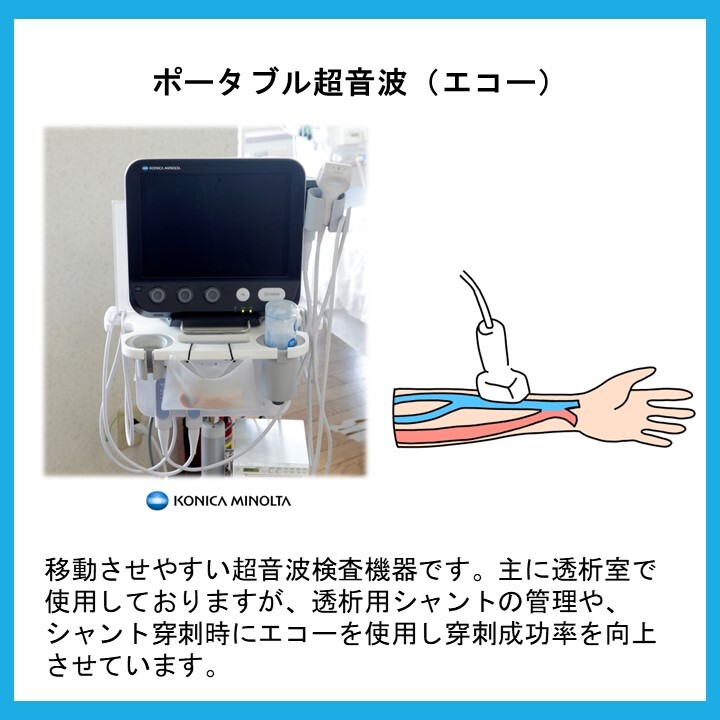 ポータブル超音波